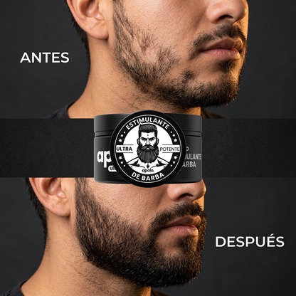 Antes y despues del uso de Apolo en la barba